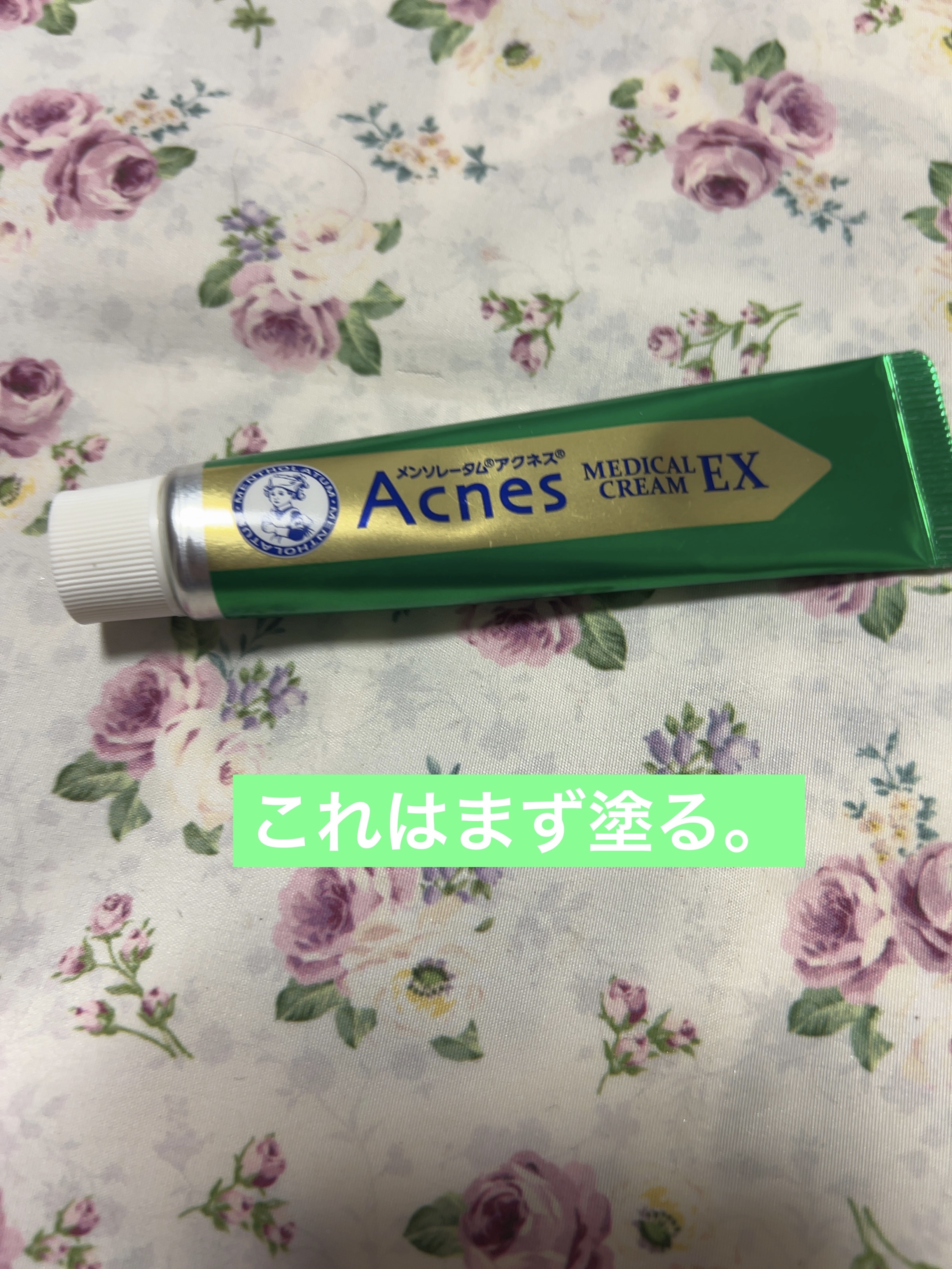 メンソレータム アクネス25 メディカルクリームEXa(医薬品)/メンソレータム アクネス25/その他を使ったクチコミ（2枚目）