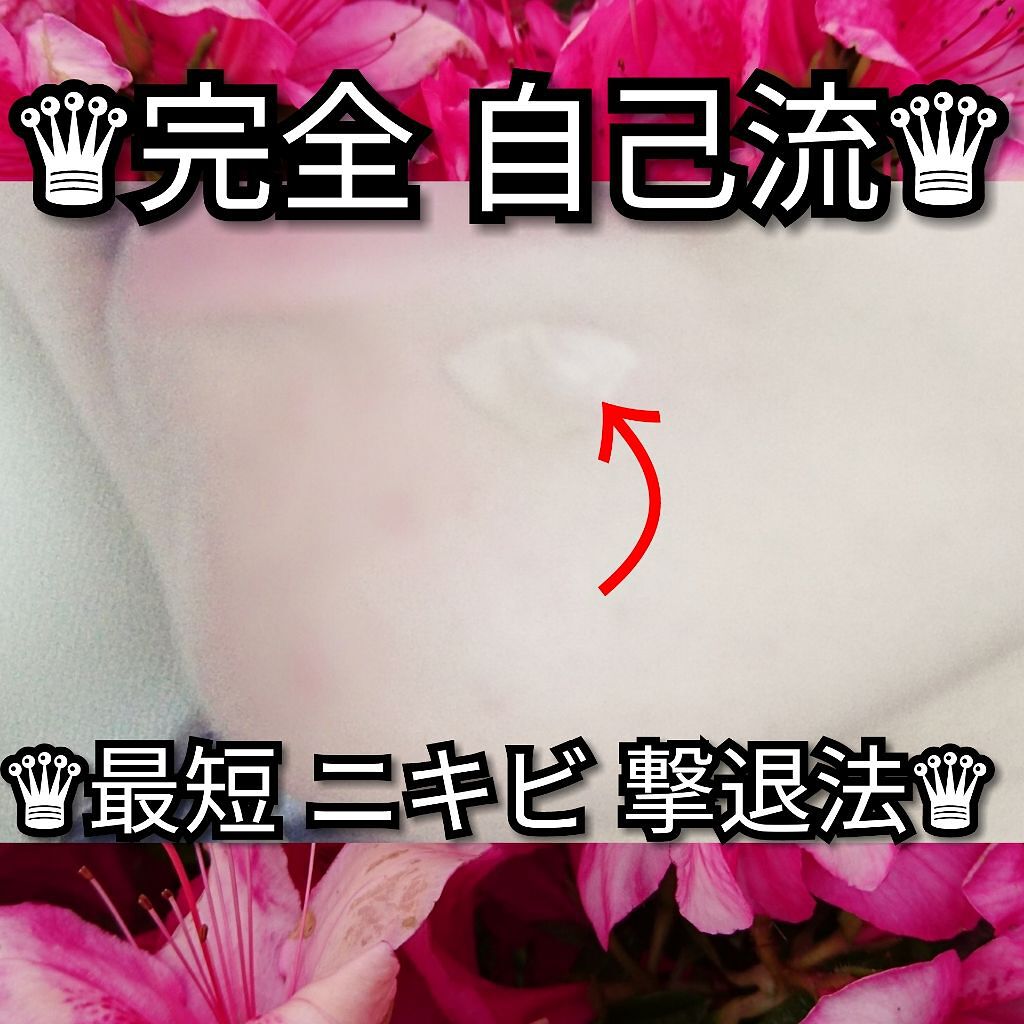 キズパワーパッド/バンドエイド/その他を使ったクチコミ(1枚目)