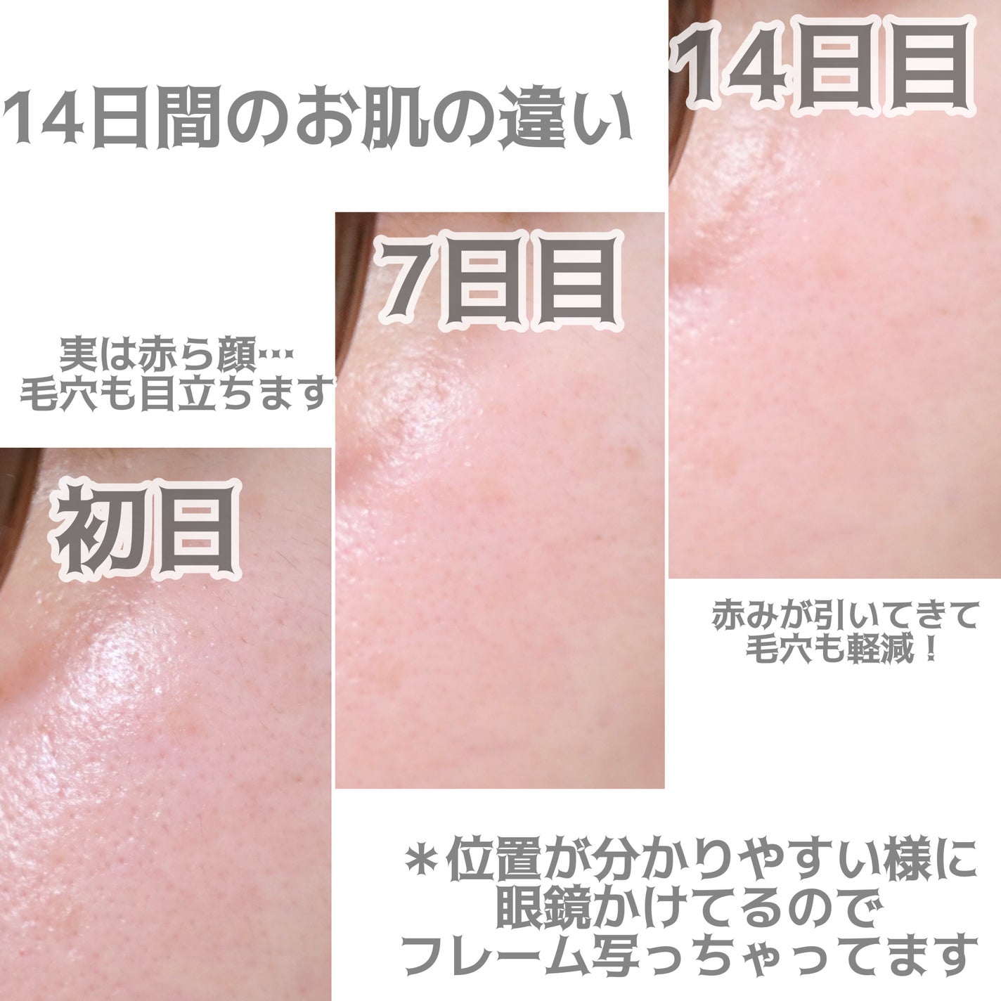 リードルショット100/VT/美容液を使ったクチコミ(6枚目)