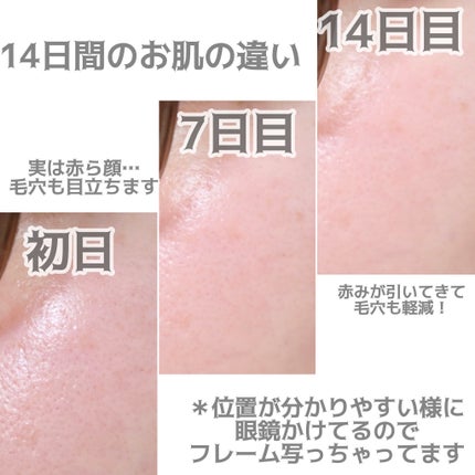 リードルショット100/VT/美容液を使ったクチコミ(6枚目)