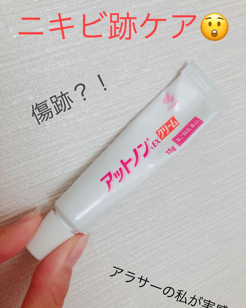 アットノンEX クリーム(医薬品)/アットノン/その他を使ったクチコミ(1枚目)