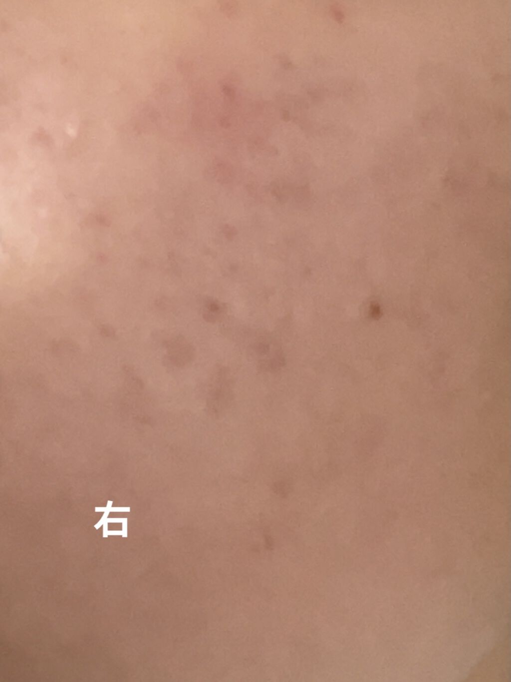 ハトムギ化粧水(ナチュリエ スキンコンディショナー R )/ナチュリエ/化粧水を使ったクチコミ（2枚目）