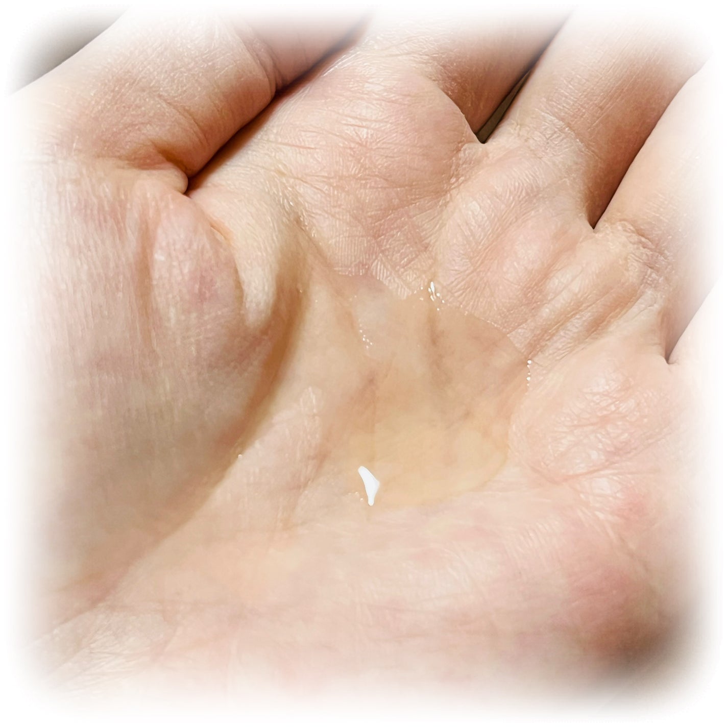 メディショットNA10 リンクル濃化粧水/MEDI SHOT/化粧水を使ったクチコミ(2枚目)