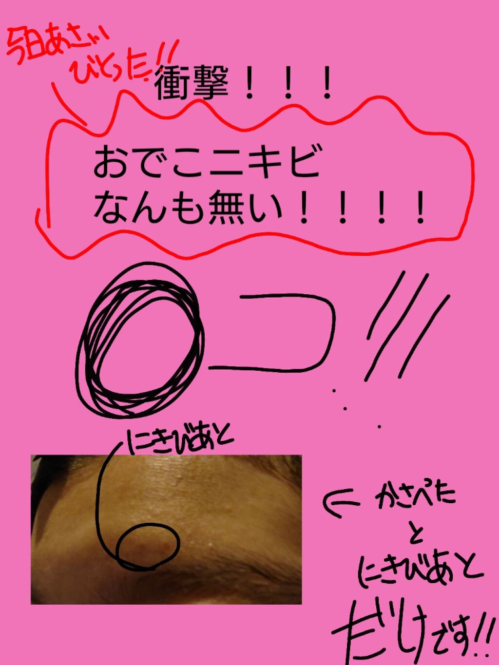 ハトムギ保湿ジェル(ナチュリエ スキンコンディショニングジェル)/ナチュリエ/美容液を使ったクチコミ（3枚目）