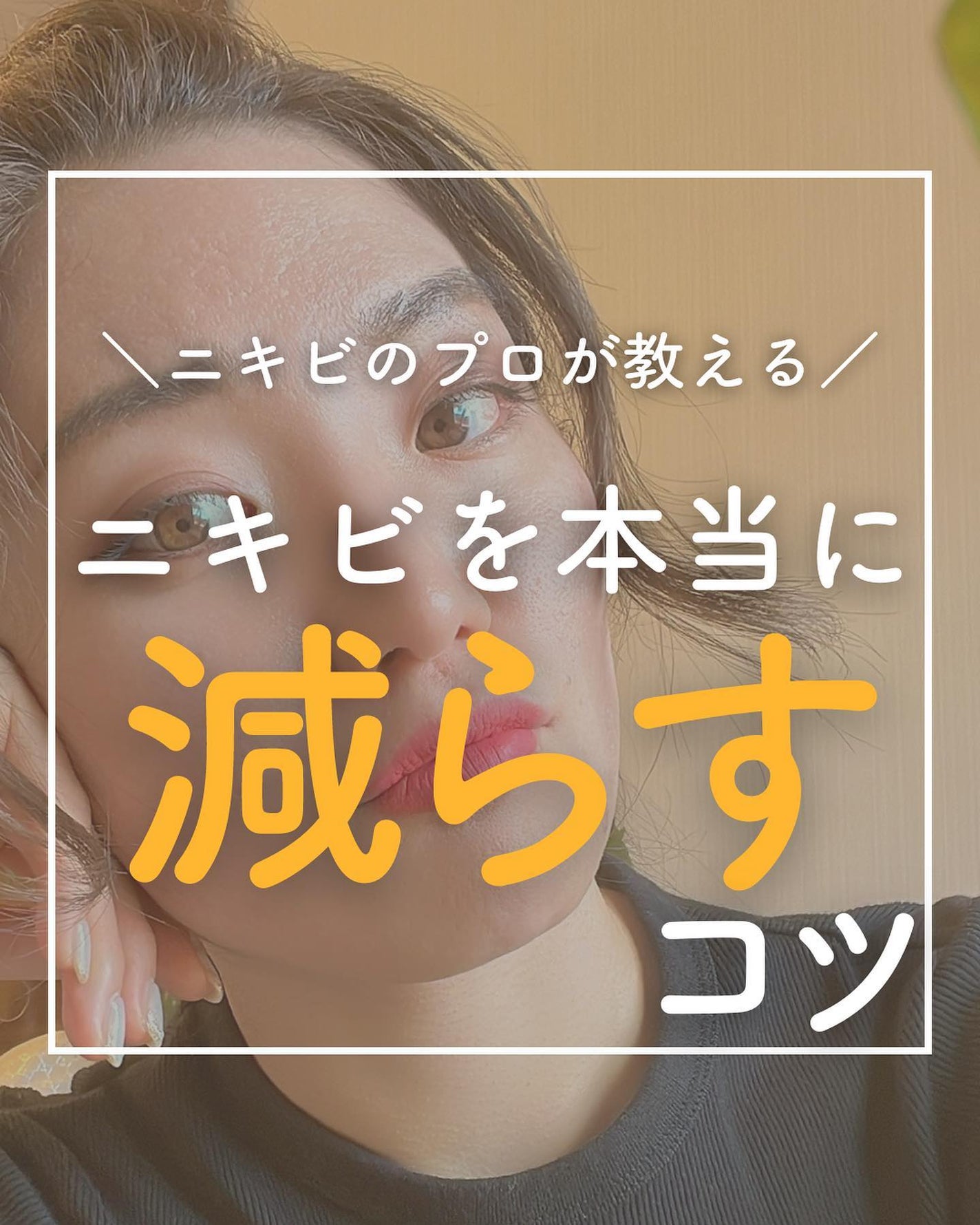 おゆみ|ニキビ・ニキビ跡ケア on LIPS 「@______ohyoume他の投稿はこちらから✨ニキビに悩ん..」(1枚目)
