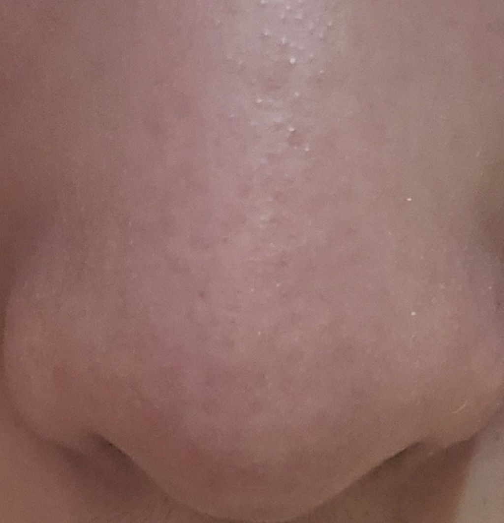 シラクル ビューティシート/Ciracle/トナーパッドを使ったクチコミ（3枚目）