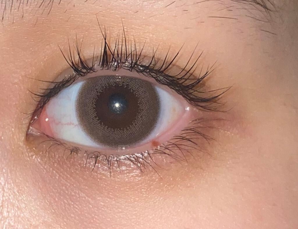 ゆめ on LIPS 「ひさひざエマーキット使ったり使わなかったりしてたら、親に目の周..」(1枚目)