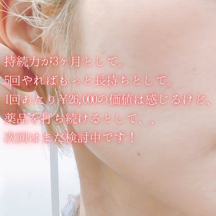 ぴょんこ on LIPS 「食いしばりによる身体の不調、「歯が割れそうです」と歯科検診で言..」(4枚目)