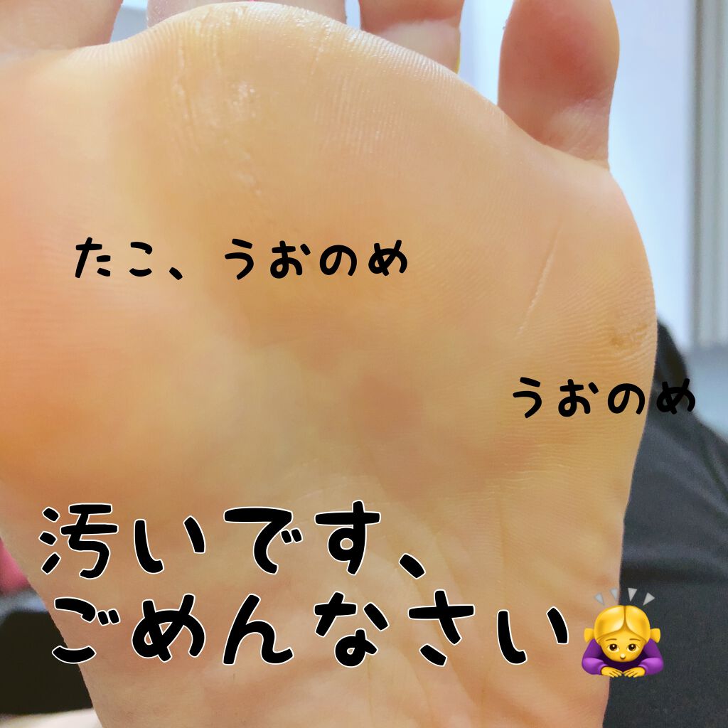 ビューティフットファイル ニールズヤード レメディーズの使い方を徹底解説 超頑固なうおのめとたこに悩む私がオススメす By チェル 健康オタク 混合肌 Lips