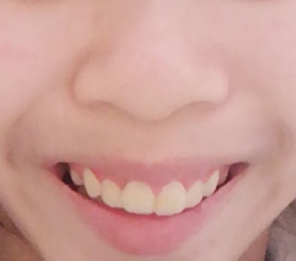 まほ on LIPS 「初めまして。まほと申します🙇♀️上の写真お見苦しいものですが..」(3枚目)