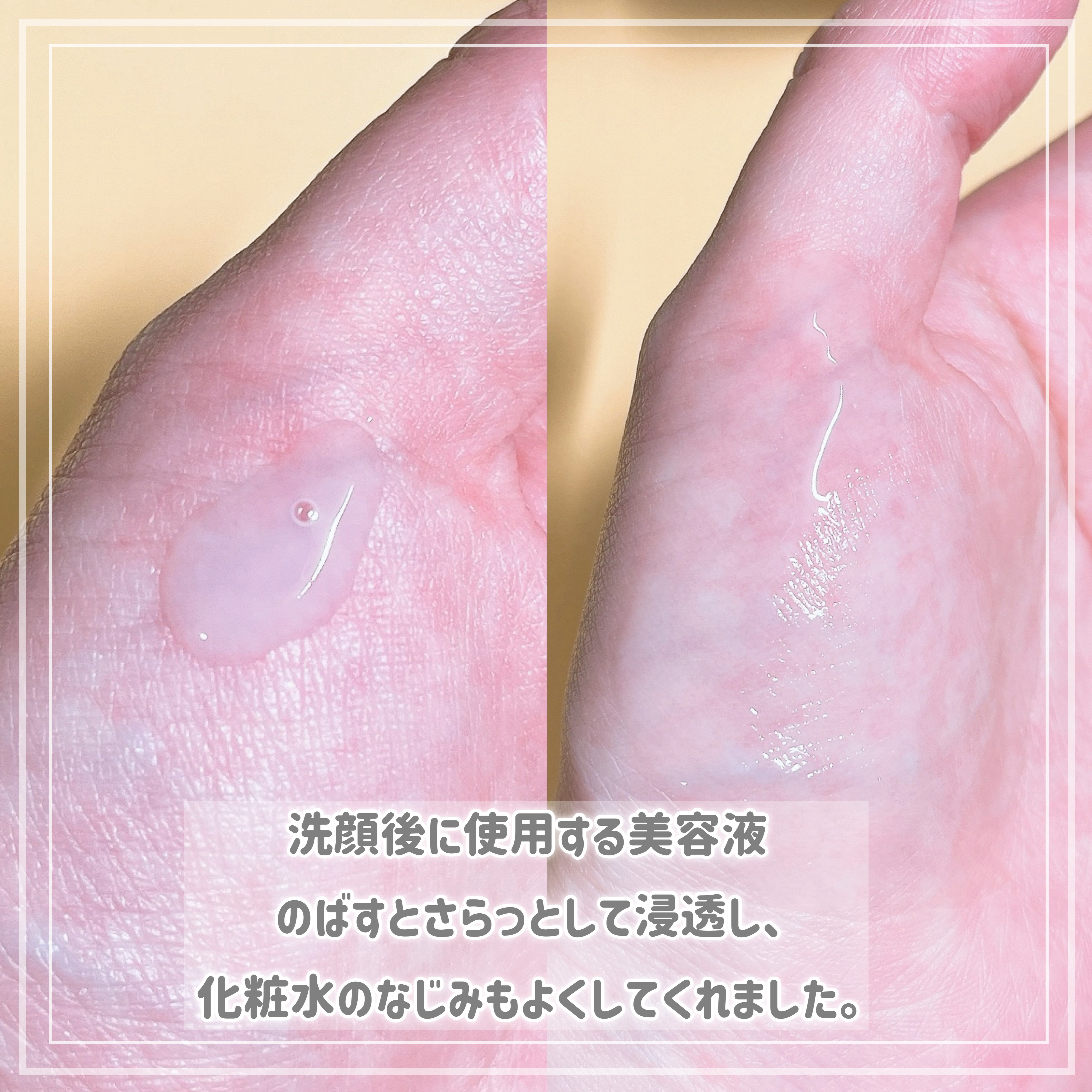 ビタプル ディープリペア セラム/VITAPURU/美容液を使ったクチコミ（2枚目）