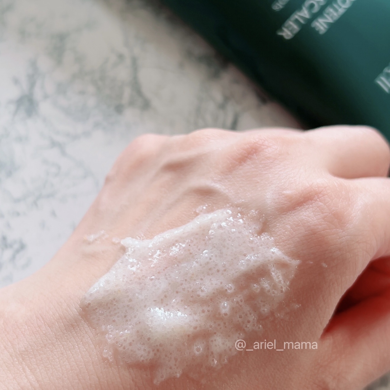 カロテンクーリングスケーラー/treecell/頭皮クレンジングを使ったクチコミ（3枚目）