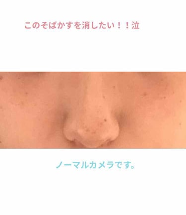 く。 on LIPS 「鼻上ほっぺのそばかすを消したい！！約6年外部でした😭日焼け止め..」（1枚目）