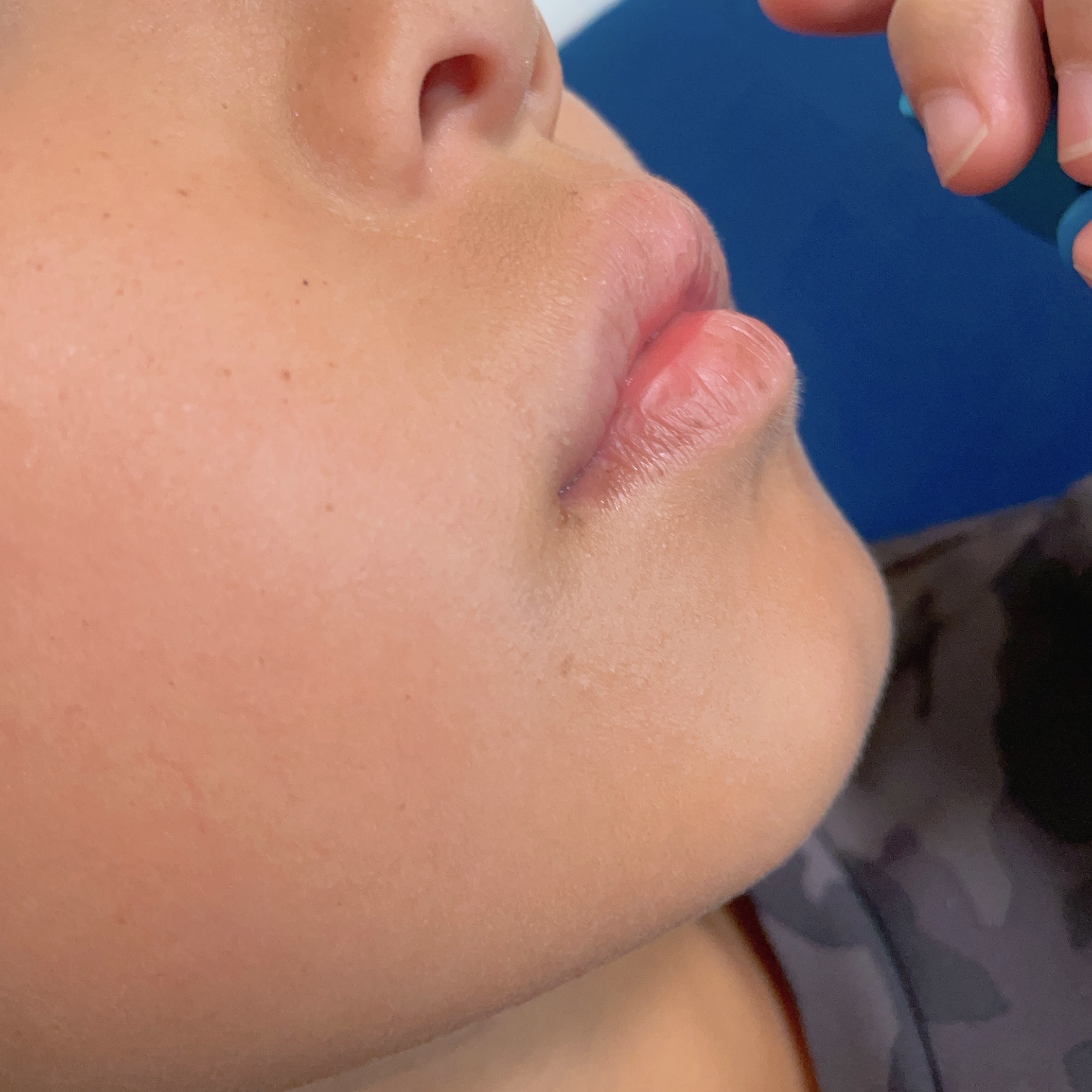 ロコベースリペア リップクリーム/ロコベース/リップクリームを使ったクチコミ（3枚目）