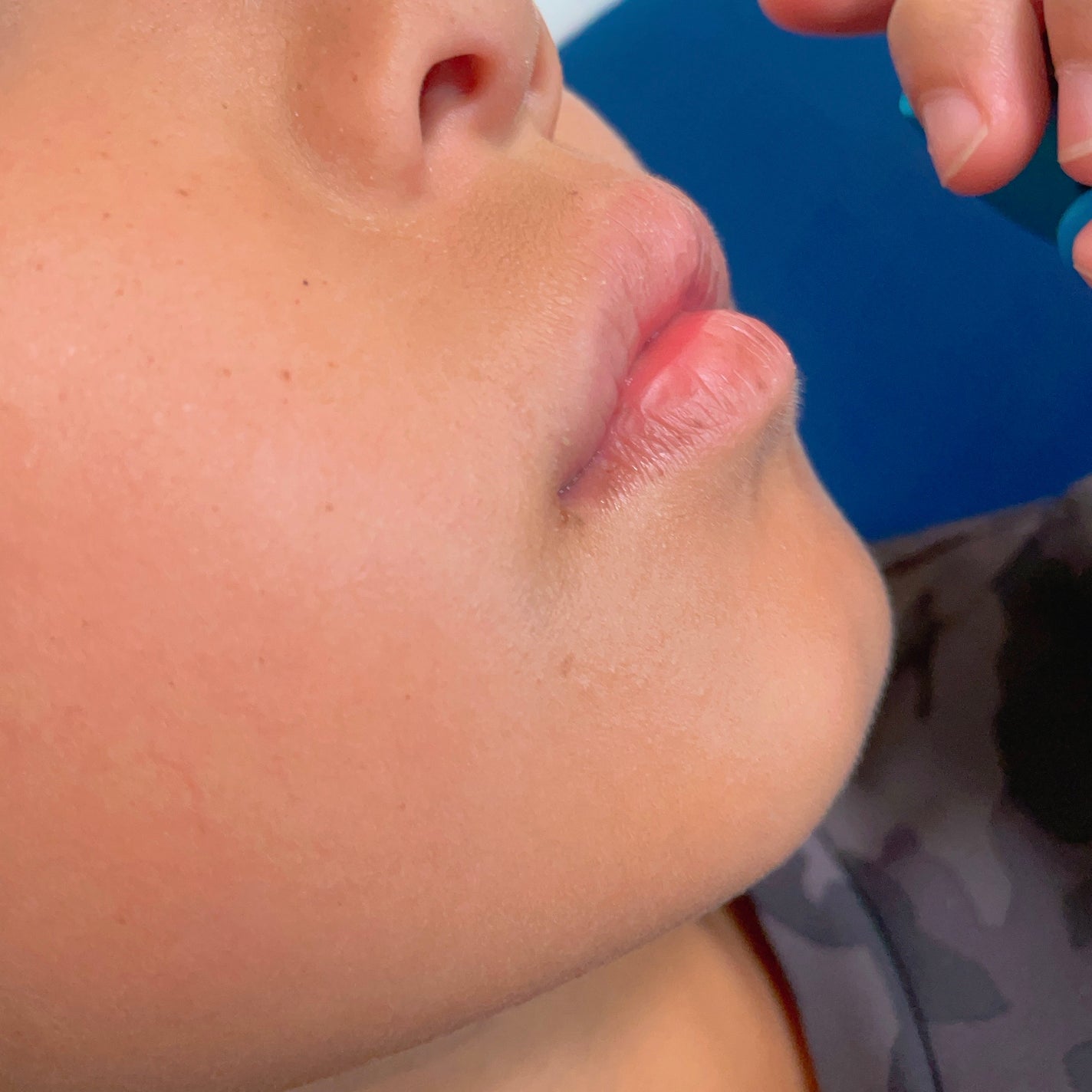 ロコベースリペア リップクリーム/ロコベース/リップクリームを使ったクチコミ(3枚目)