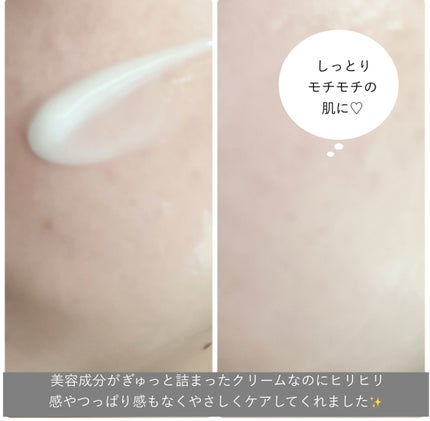 レッドブレミッシュ クリアスージングクリーム/Dr.G/フェイスクリームを使ったクチコミ(4枚目)