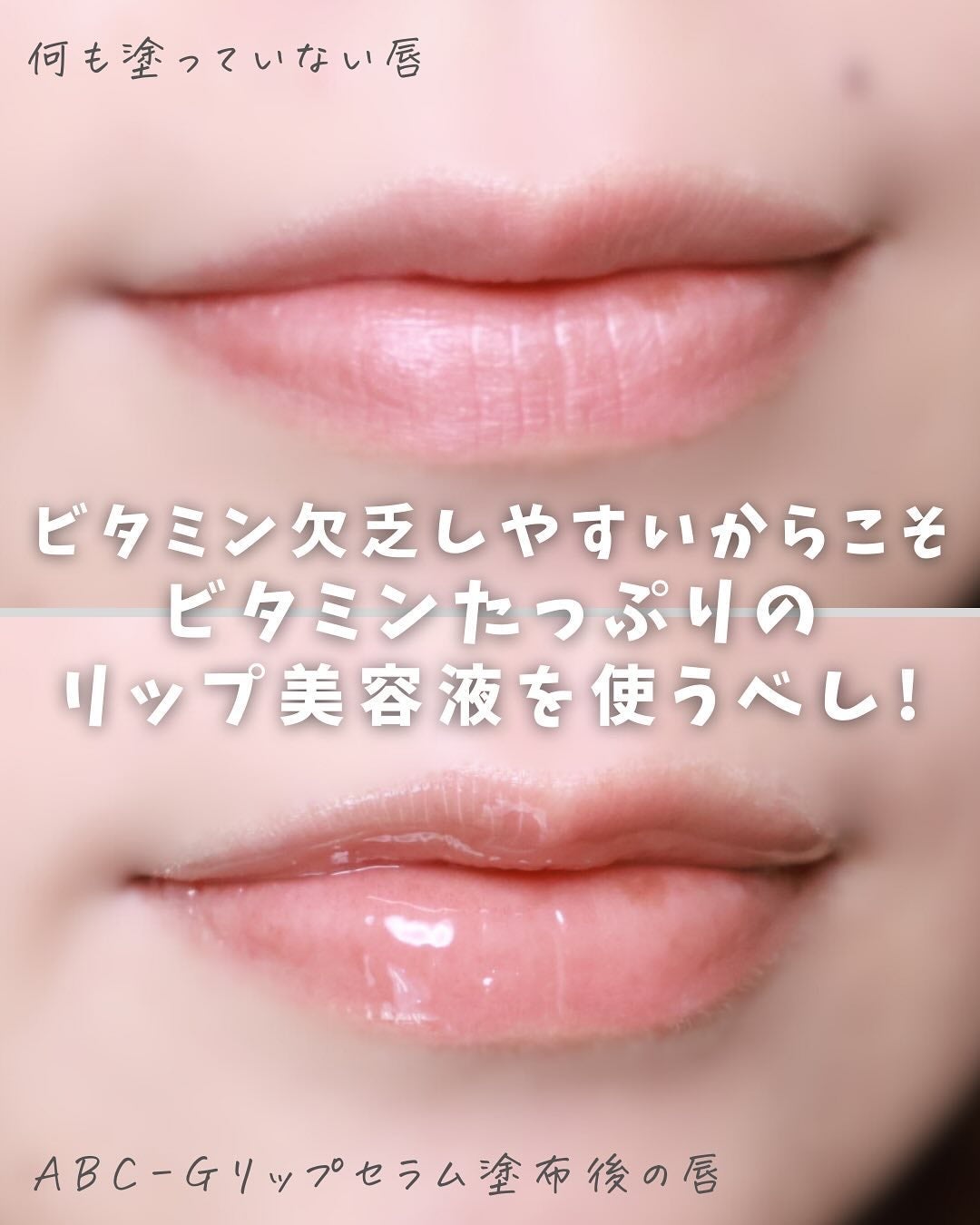 ABC-Gリップセラム/ドクターケイ/リップ美容液を使ったクチコミ(3枚目)