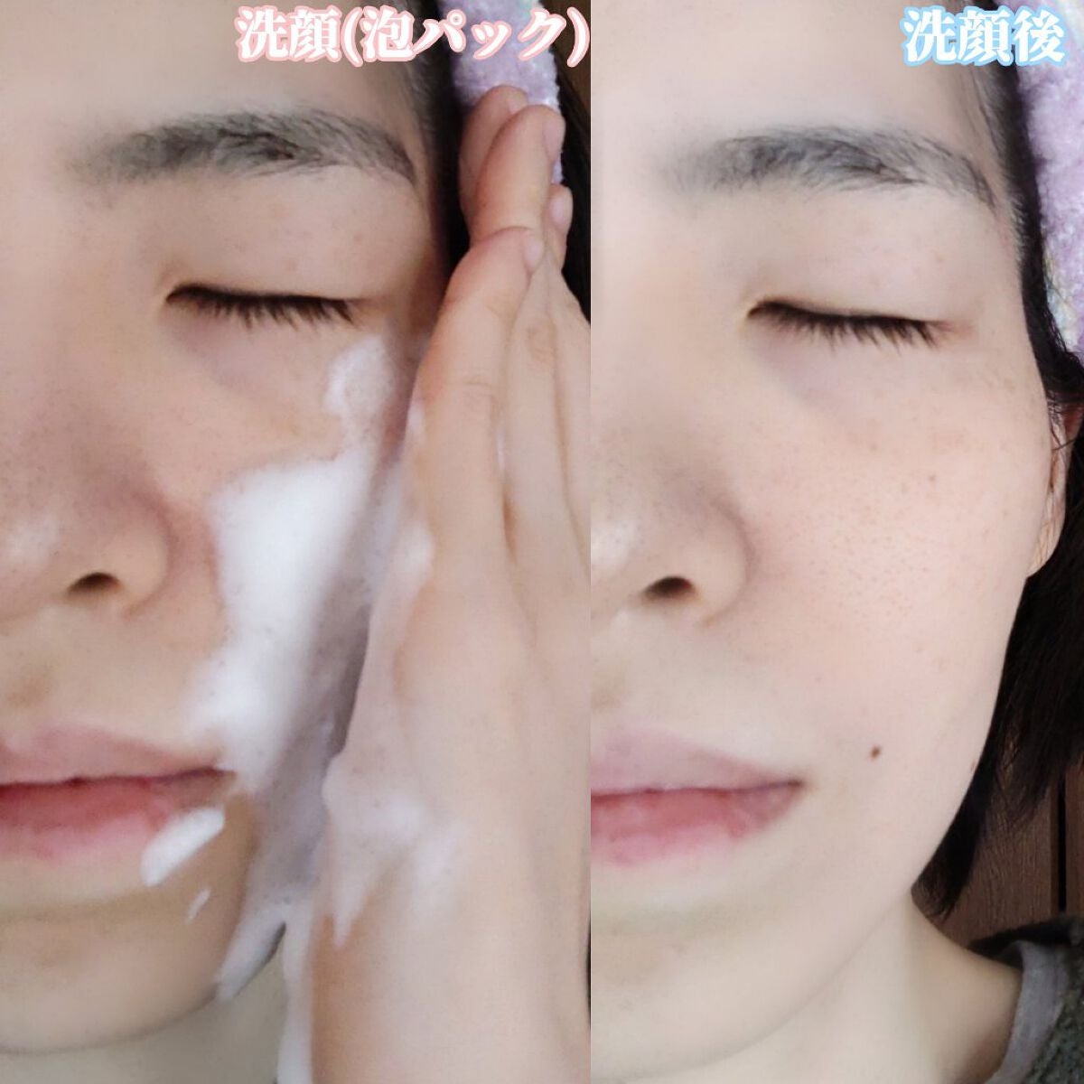 ヒアテノール アンプル/ネイチャーリパブリック/美容液を使ったクチコミ(4枚目)