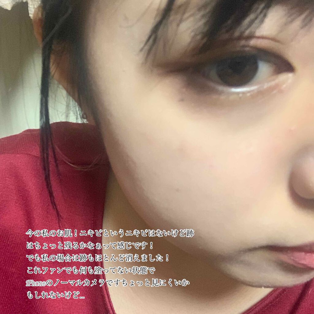 ハトムギ化粧水(ナチュリエ スキンコンディショナー R )/ナチュリエ/化粧水を使ったクチコミ(4枚目)