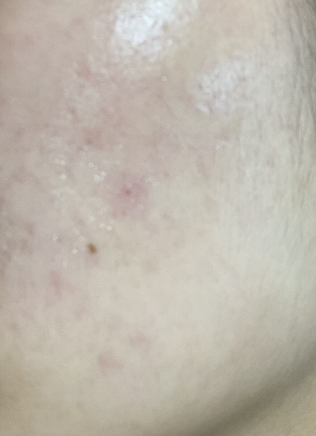 ミノン アミノモイスト モイストチャージ ミルク/ミノン/乳液を使ったクチコミ（3枚目）