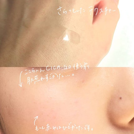 シカゴ― シカダブルエフェクトアンプル/ISOI/美容液を使ったクチコミ(2枚目)