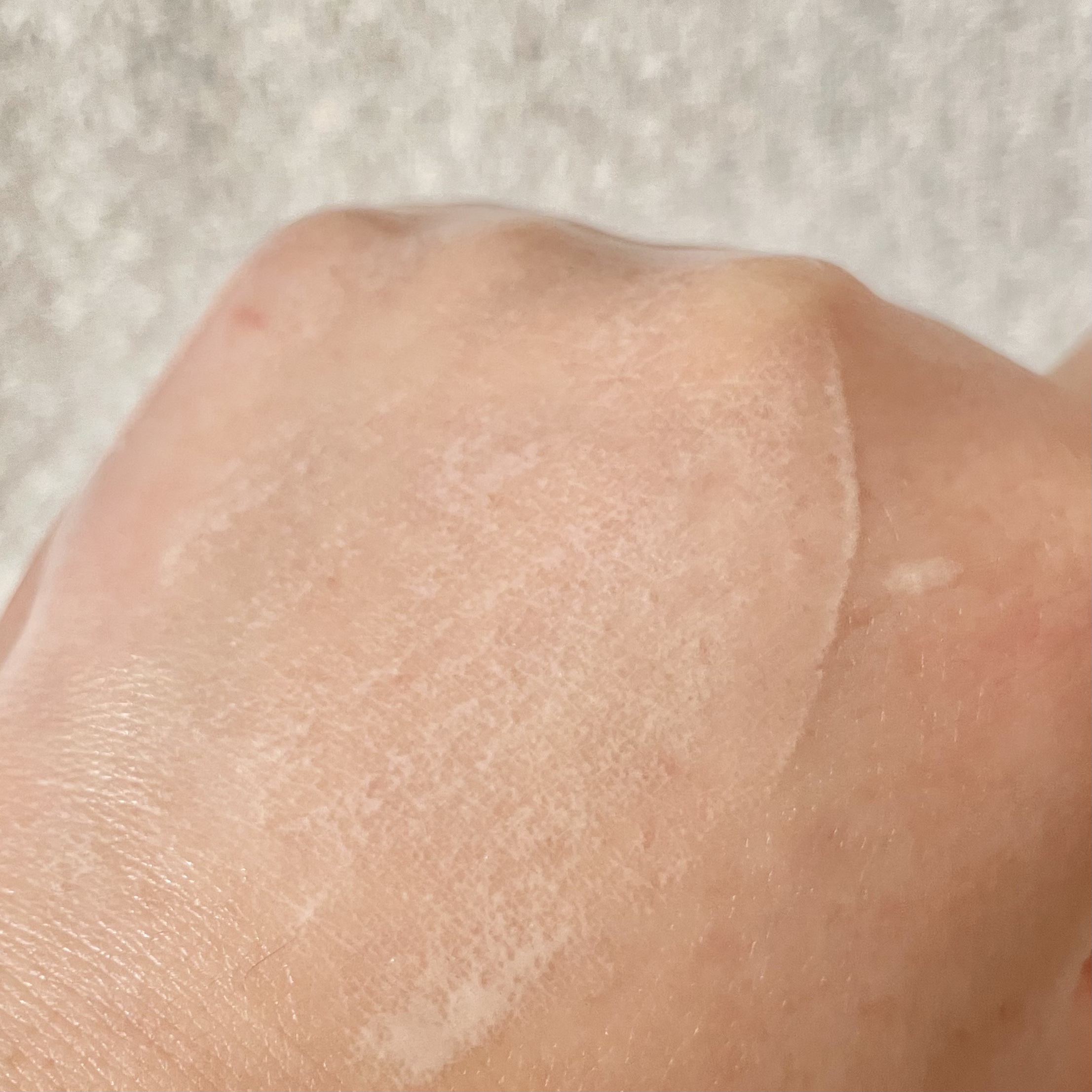 プロテクトフォームP/syante/その他を使ったクチコミ（3枚目）