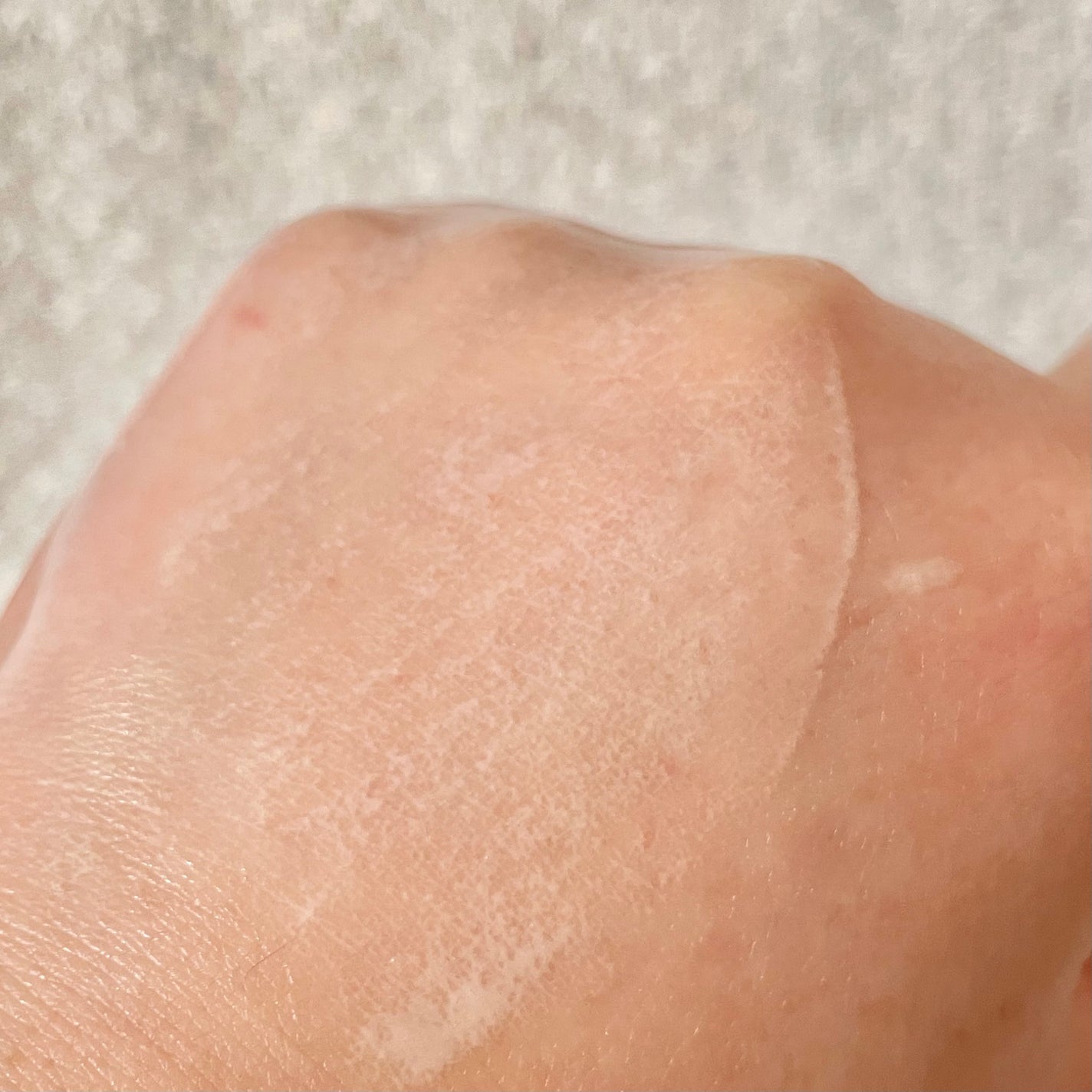 プロテクトフォームP/syante/その他を使ったクチコミ(3枚目)