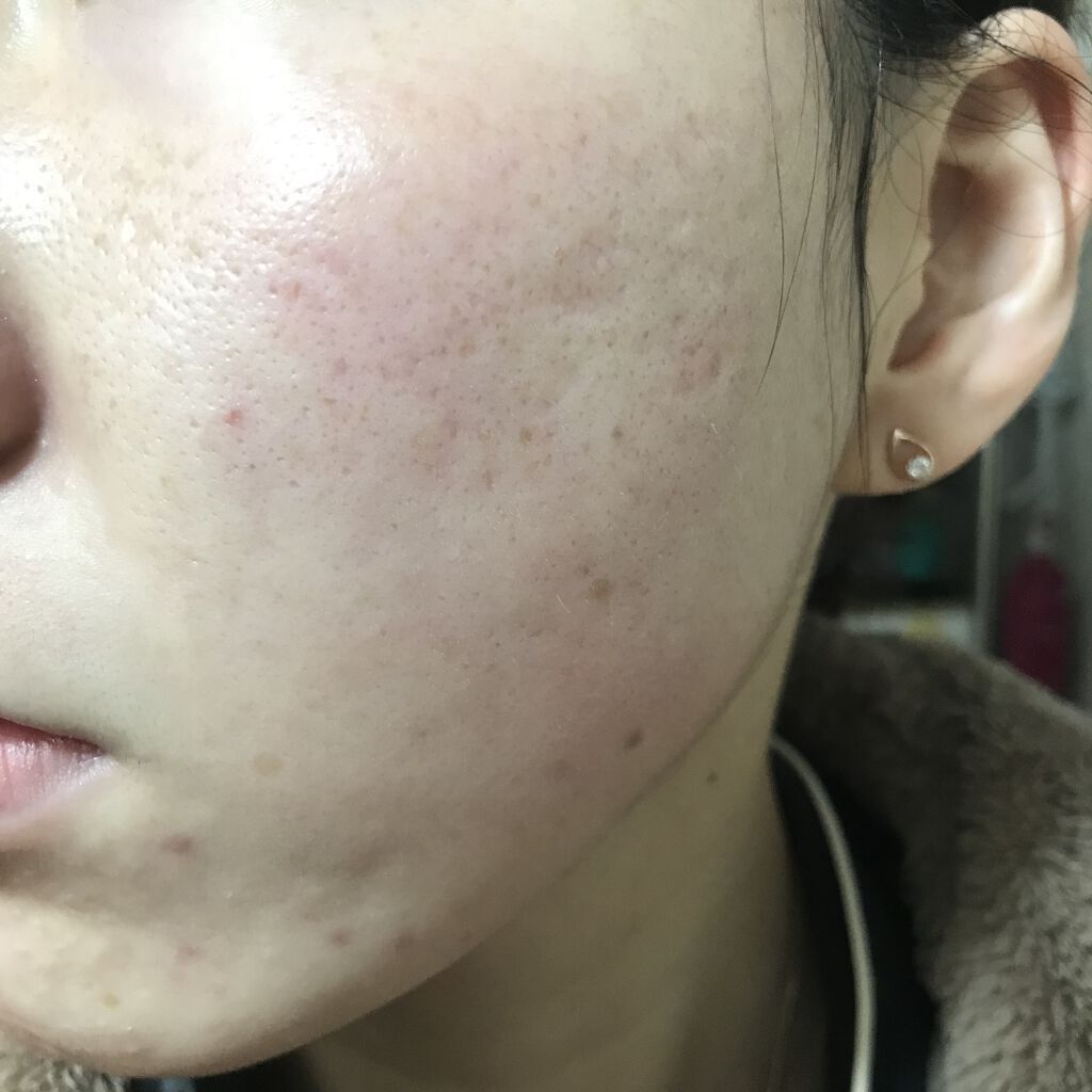 リバイタライジングビタミンAコンプレックス/Sympli Beautiful/美容液を使ったクチコミ（2枚目）