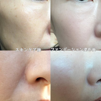 タンイドル ウルトラ ウェア リキッド N/LANCOME/リキッドファンデーションを使ったクチコミ(4枚目)