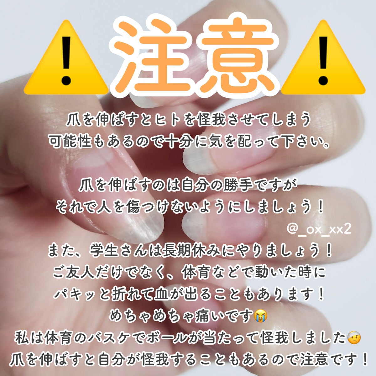 デイケアオイル/Dr.Nail/ネイルオイル・トリートメントを使ったクチコミ(6枚目)