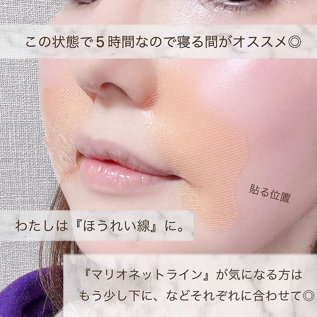 ダーマフィラースマイル/Quanis/シートマスク・パックを使ったクチコミ(2枚目)