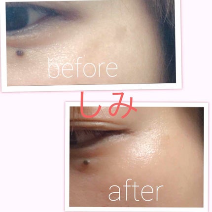 7 day Special Set プログラム2/b.glen/トライアルキットを使ったクチコミ(4枚目)