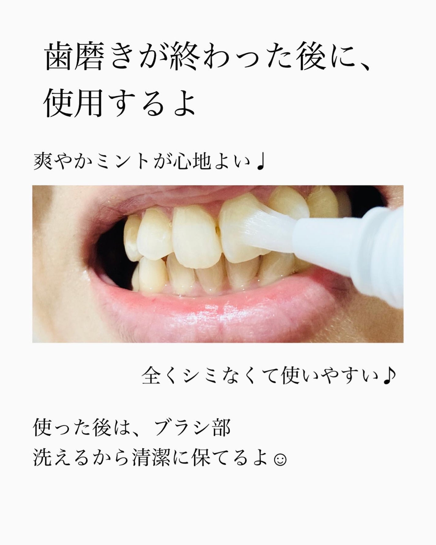 薬用ホワイトニング デンタブラッシュ/シーヴァ/その他オーラルケアを使ったクチコミ(4枚目)