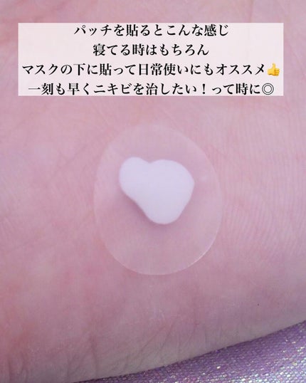 薬用ニキビケア スポッツクリーム/アクネスラボ/フェイスクリームを使ったクチコミ(4枚目)