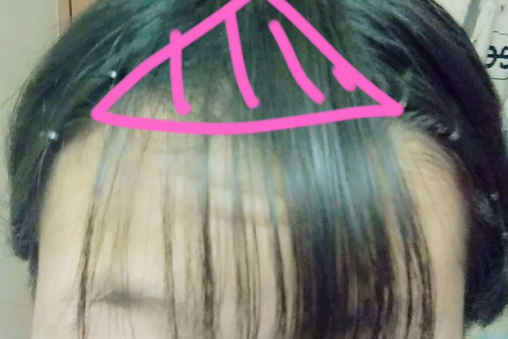 まとめ髪スティック スーパーホールド/マトメージュ/ヘアワックス・クリームを使ったクチコミ(5枚目)