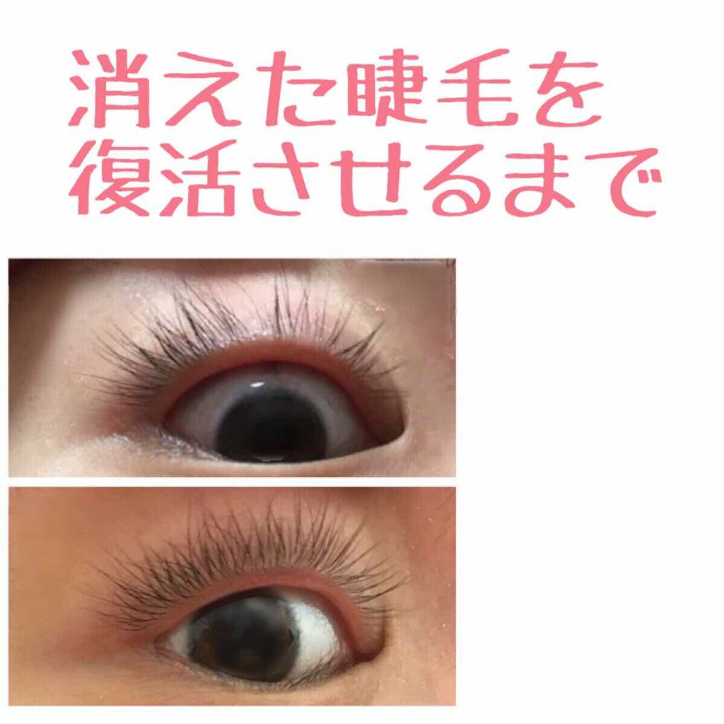 リバイタラッシュ アドバンス ジャパン/エム・アール・アイ/まつげ美容液を使ったクチコミ(1枚目)