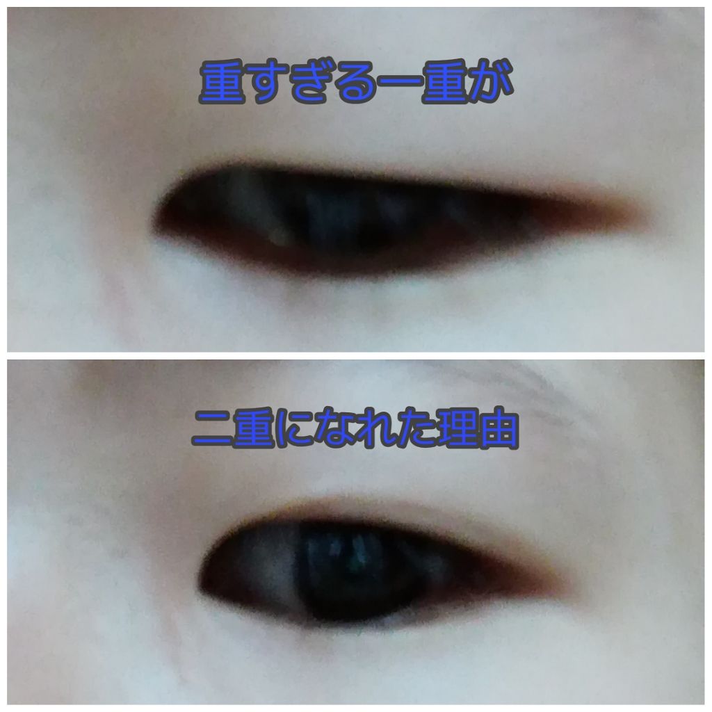 アイトーク/アイトーク/二重まぶた用アイテムを使ったクチコミ(1枚目)