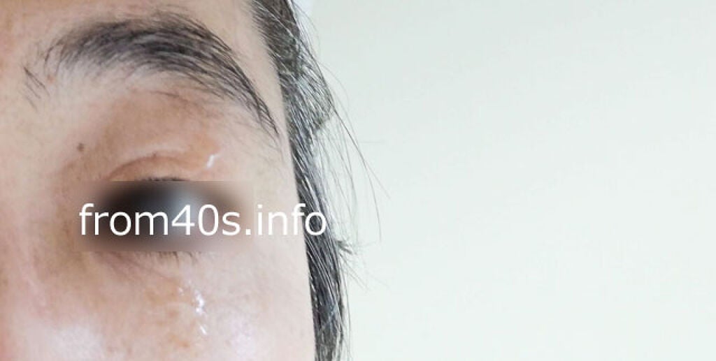 アイバッグセラム/O2VITA(オー・ドゥエ・ヴィータ)/アイケア・アイクリームを使ったクチコミ(4枚目)