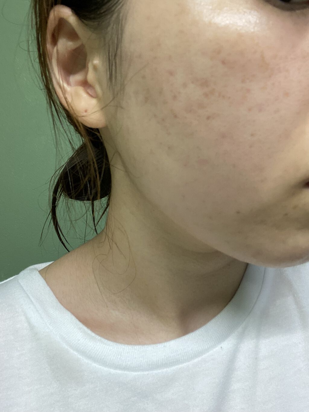 ホワイトニング ミスト セラム/アルージェ/ミスト状化粧水を使ったクチコミ（2枚目）