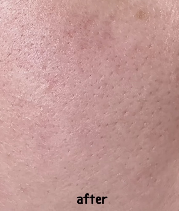 レチノール　シカ　リペア　セラム 【旧】30mL/innisfree/美容液を使ったクチコミ（3枚目）