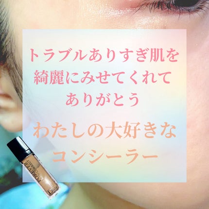 【旧】ディオールスキン フォーエヴァー スキン コレクト コンシーラー/Dior/リキッドコンシーラーを使ったクチコミ(1枚目)