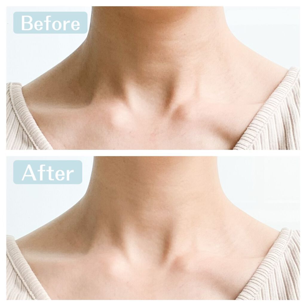 美ネック姫/himecoto/ネック・デコルテケアを使ったクチコミ(6枚目)