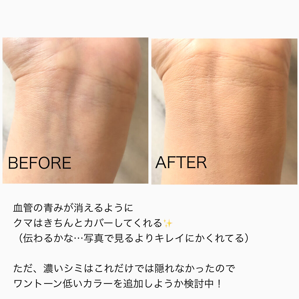 【旧】ディオールスキン フォーエヴァー スキン コレクト コンシーラー/Dior/リキッドコンシーラーを使ったクチコミ（2枚目）