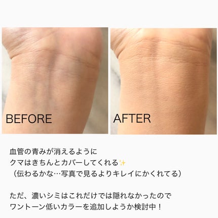 【旧】ディオールスキン フォーエヴァー スキン コレクト コンシーラー/Dior/リキッドコンシーラーを使ったクチコミ(2枚目)