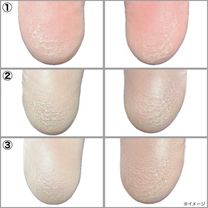 足裏角質パック ティアラローズの香り/EVERYYOU/レッグ・フットケアを使ったクチコミ(5枚目)