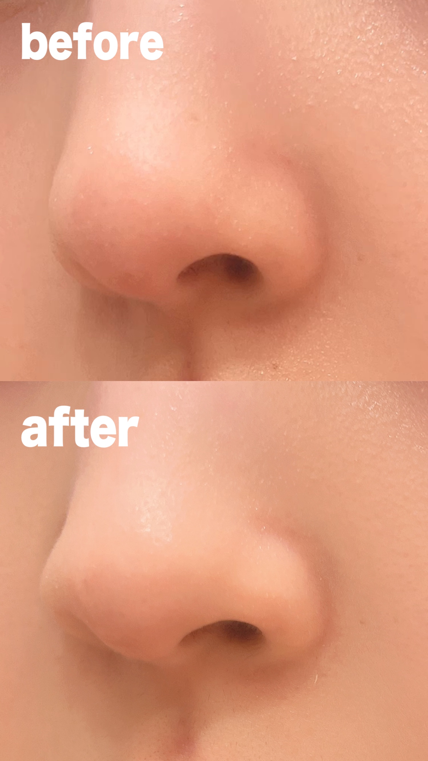 ブラックヘッドバームスクラブ/オブジェ/フェイスバームを使ったクチコミ（3枚目）