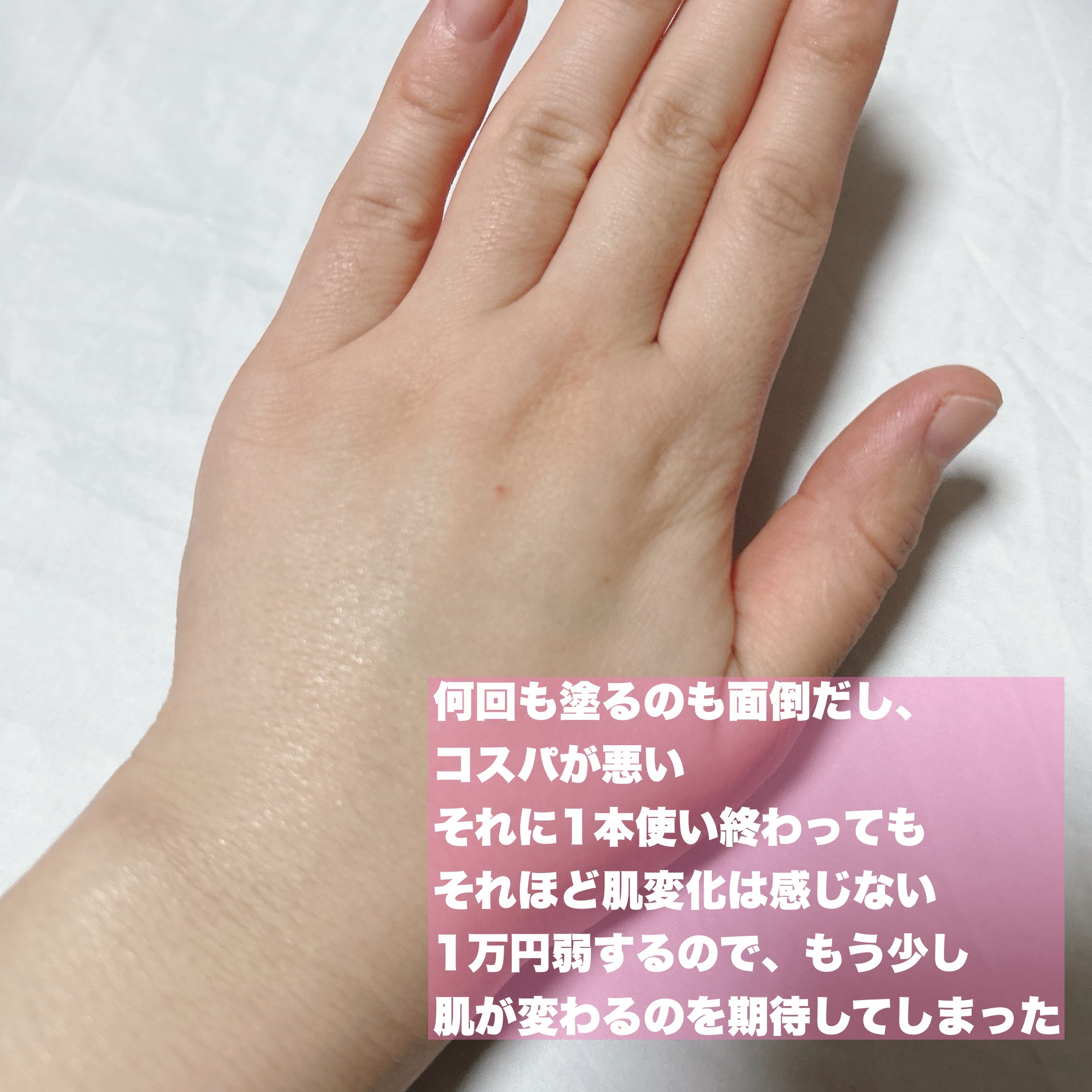 オイデルミン エッセンスローション/SHISEIDO/化粧水を使ったクチコミ（3枚目）