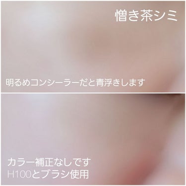 スポッツカバー ファウンデイション/SHISEIDO/コンシーラーを使ったクチコミ（2枚目）