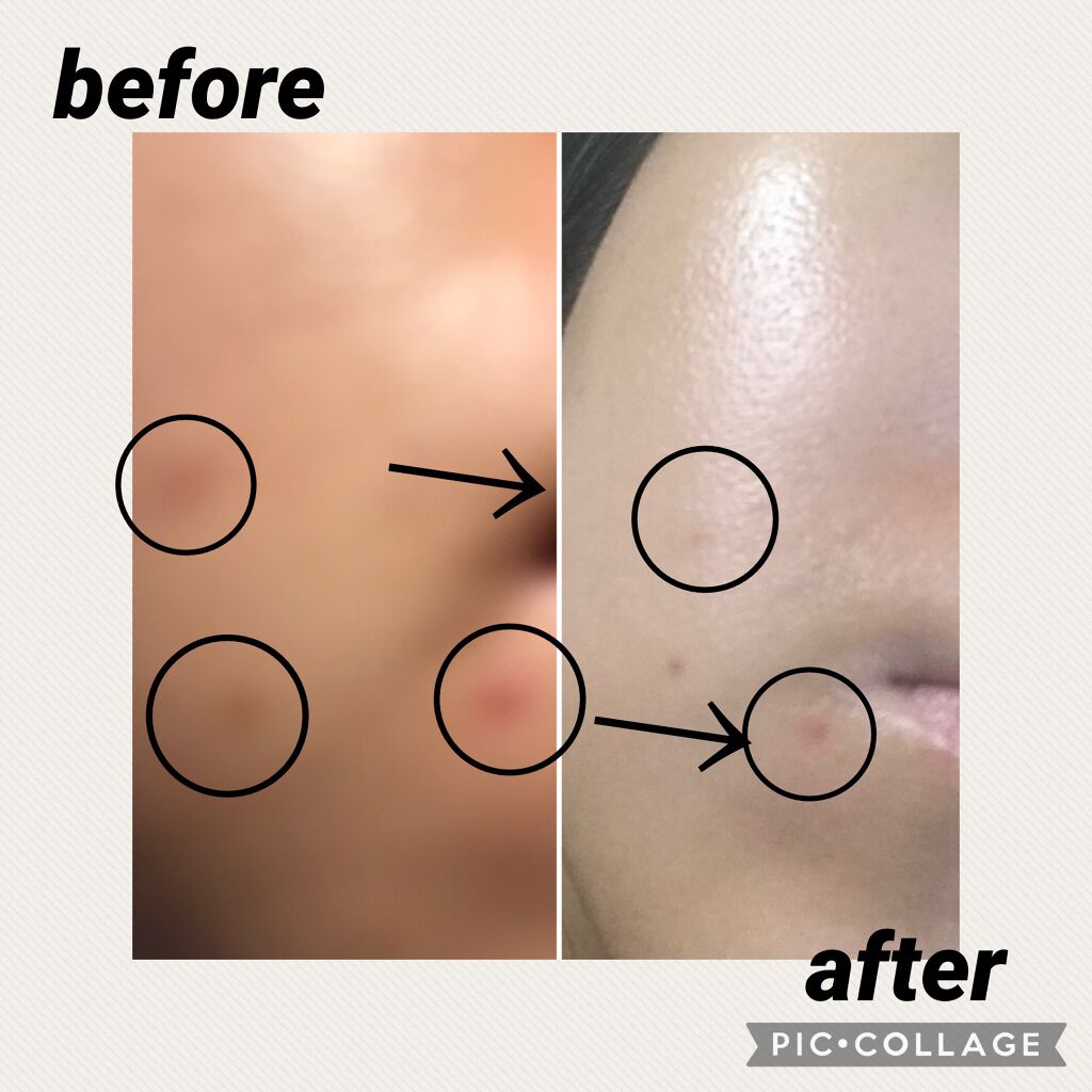 高保湿化粧水<美白> しっとり/ソフィーナ ボーテ/化粧水を使ったクチコミ(4枚目)