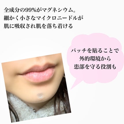 ACマグネシウムパッチ ミニ/スノーツープラス/にきびパッチを使ったクチコミ(4枚目)